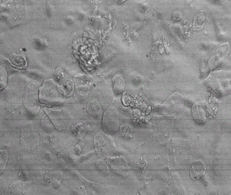 人SV40转染成骨细胞